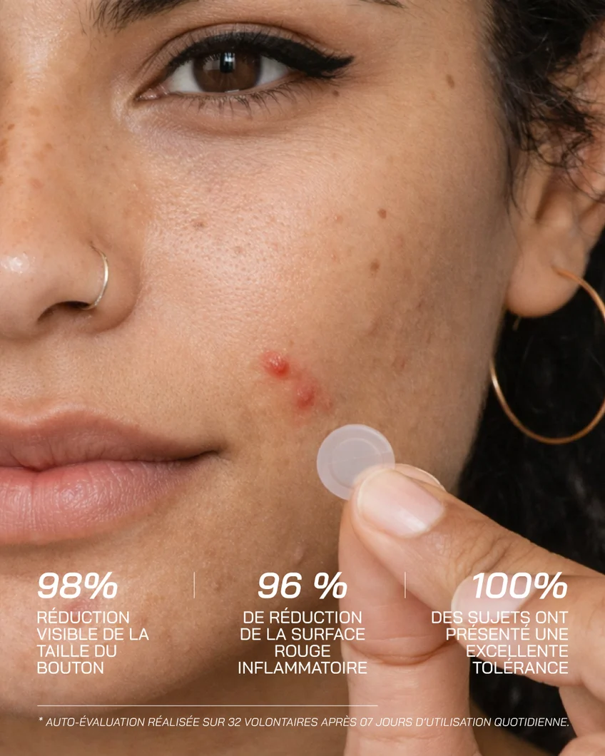 NOVERA™ Microneedle Blemish & Tag Patches
