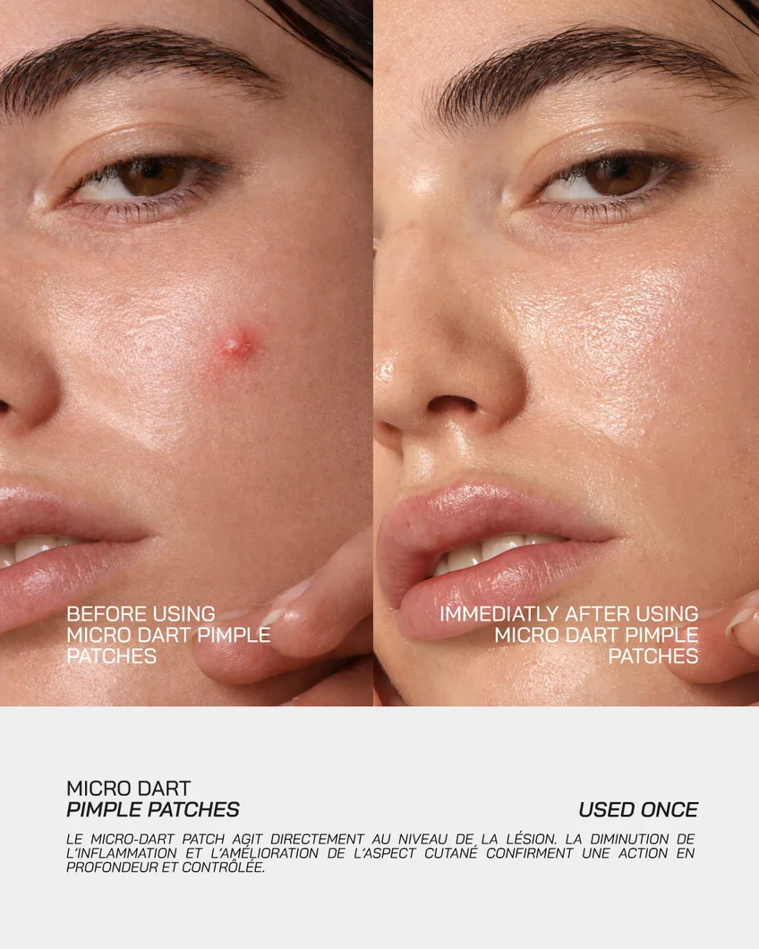 NOVERA™ Microneedle Blemish & Tag Patches